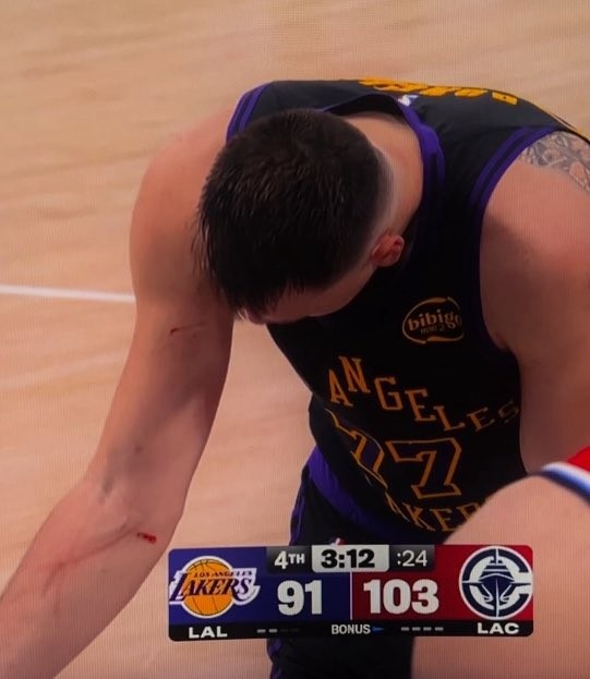 kaiyun体育-谁抓的~东契奇罚球时看向手臂 好几道伤口&amp;血迹斑斑